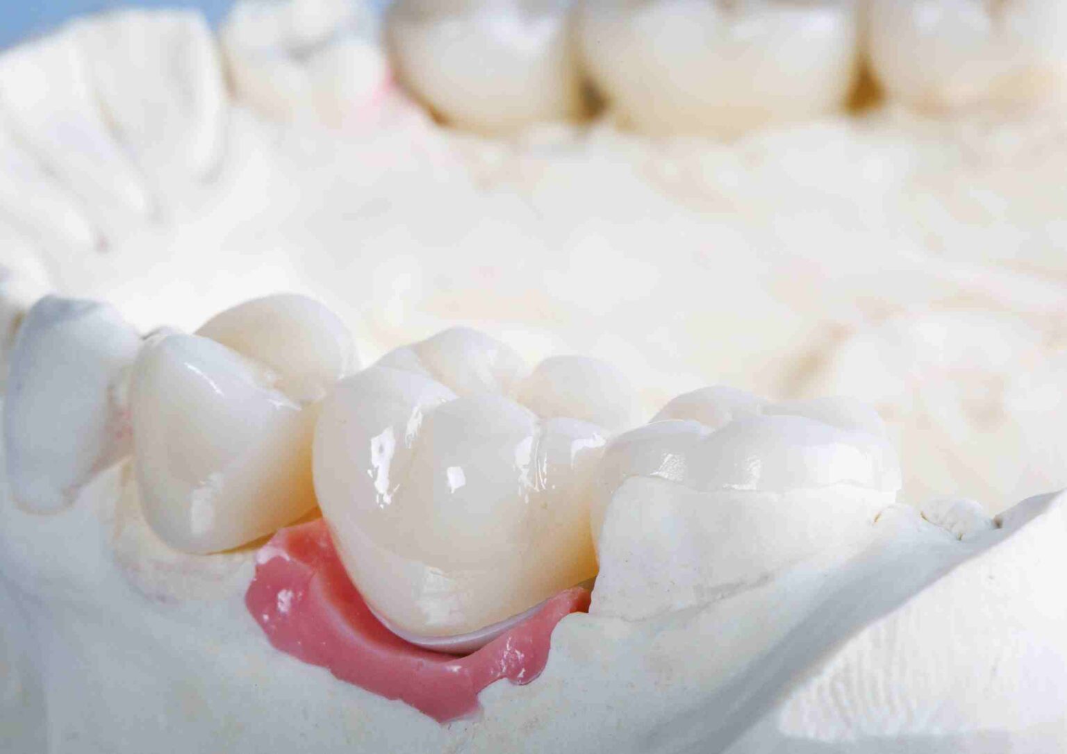 Best Mouthwash for Dental Crowns Your Guide to Oral Hygiene