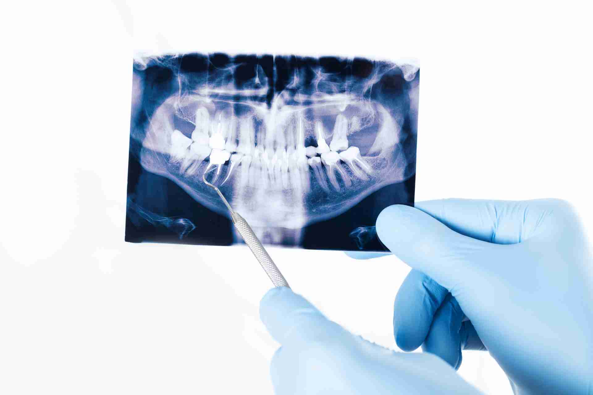 Why Does My Tooth Hurt When I Press On It?