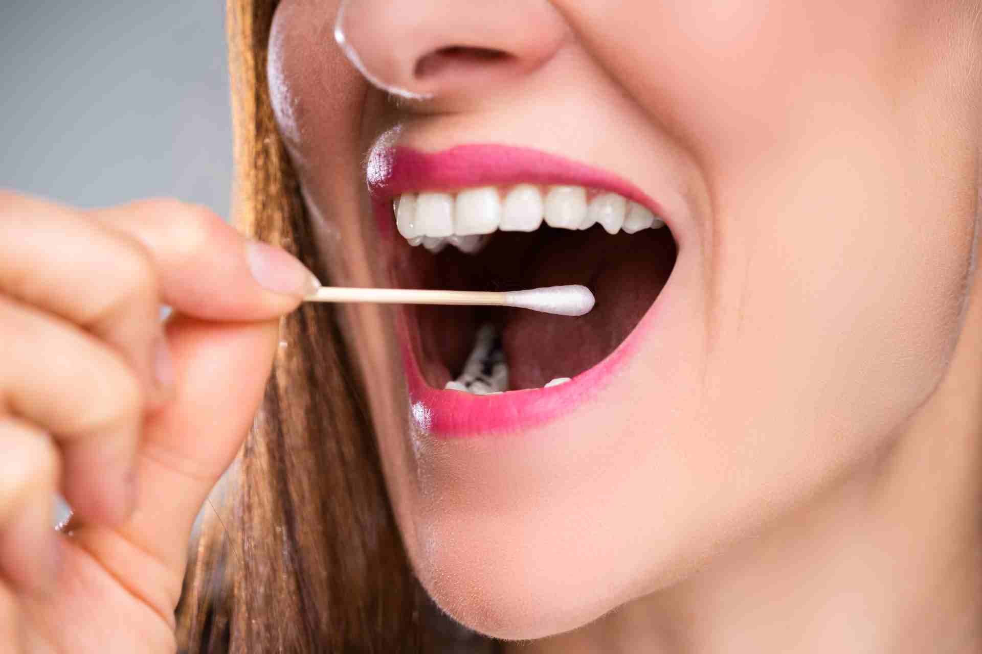Blood in Saliva Causes and Treatments Explained