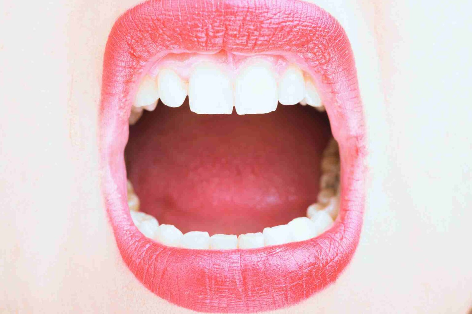 Roof of Mouth Swollen: Causes, Symptoms, Treatment