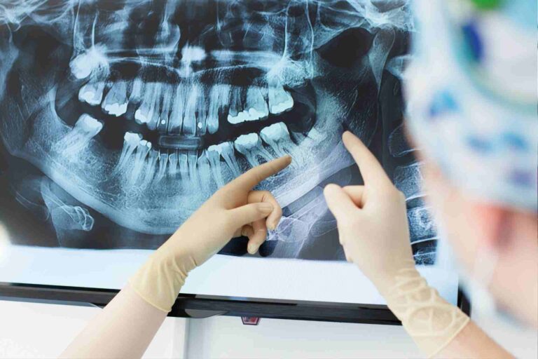 What Is an Edge-to-Edge Bite and Why Does It Matter?