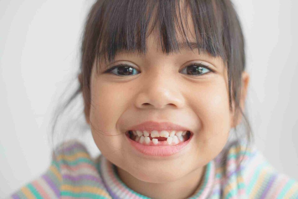 Girl showing her broken milk teeth.