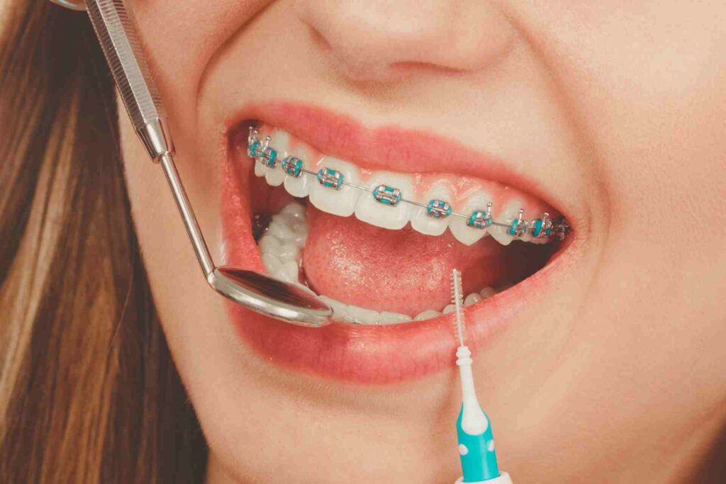 Woman smiling cleaning teeth with braces