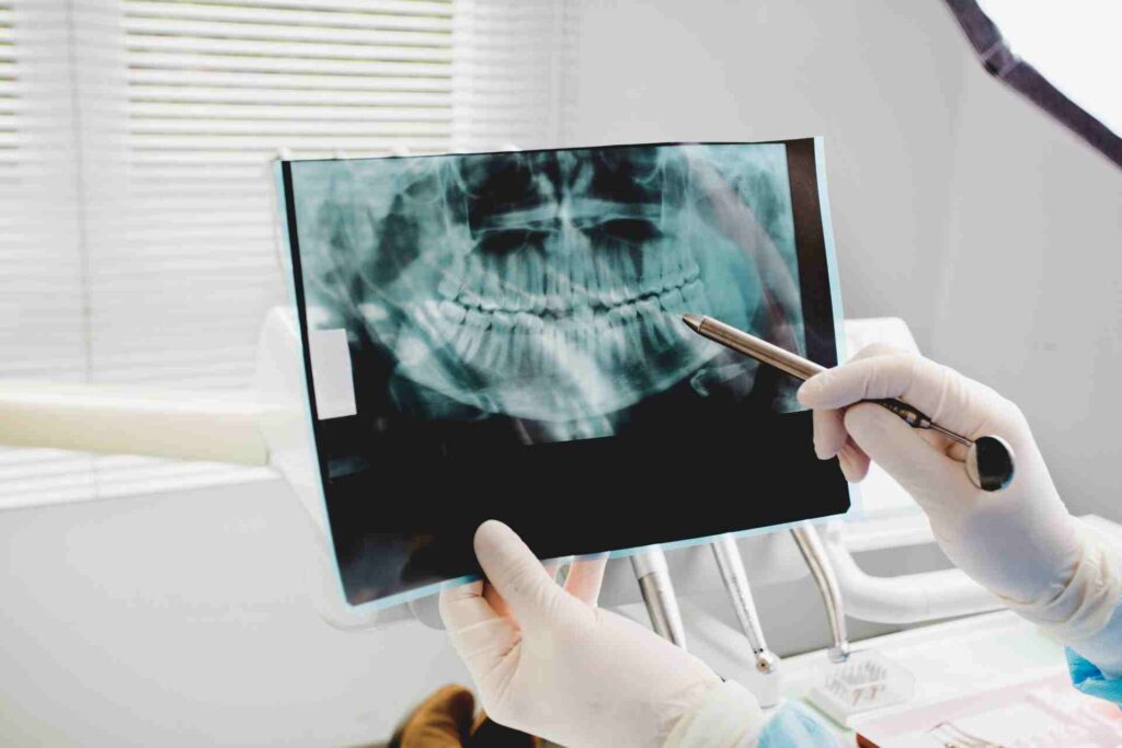 Dental X-Rays