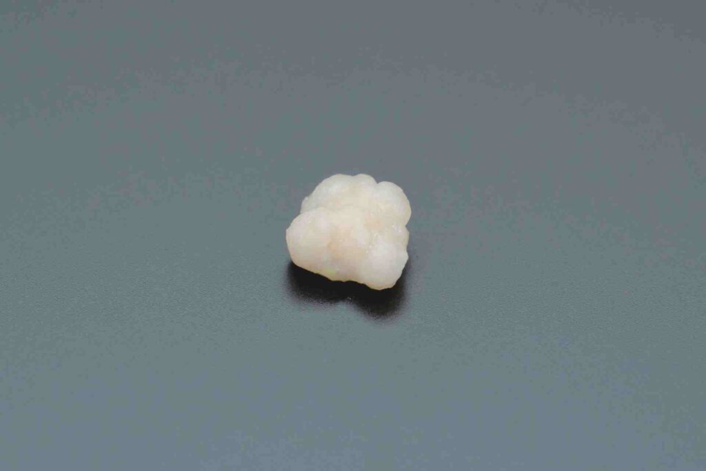 close-up on stone tonsil