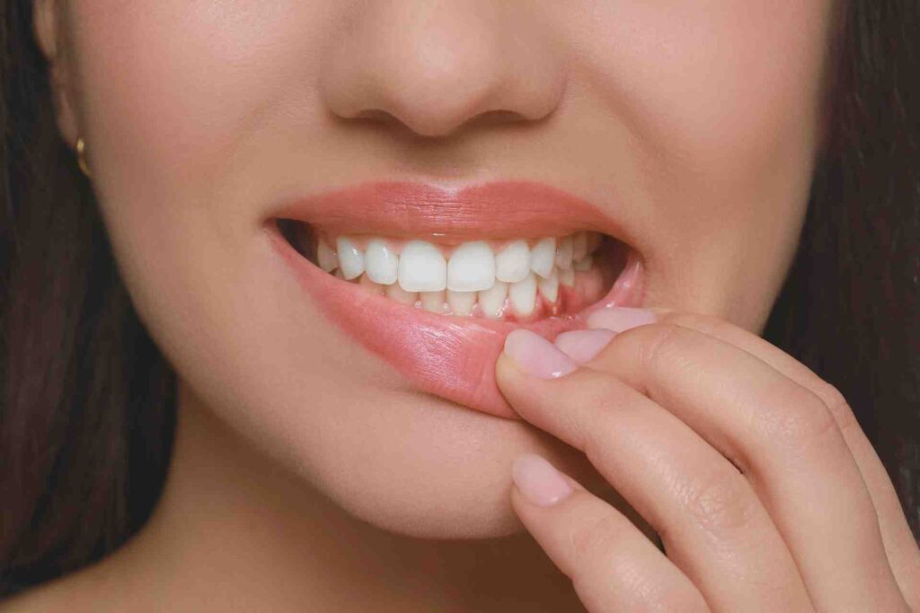 Young Woman Showing Gums.