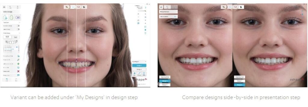 3Shape TRIOS Smile Design