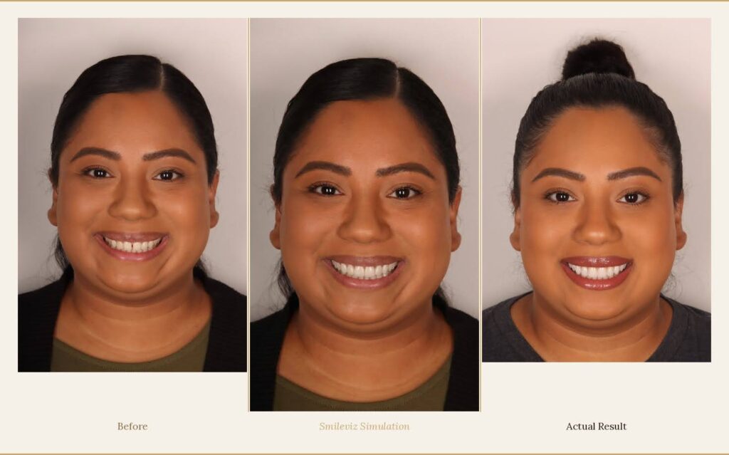 “90-second” simulations-smileviz